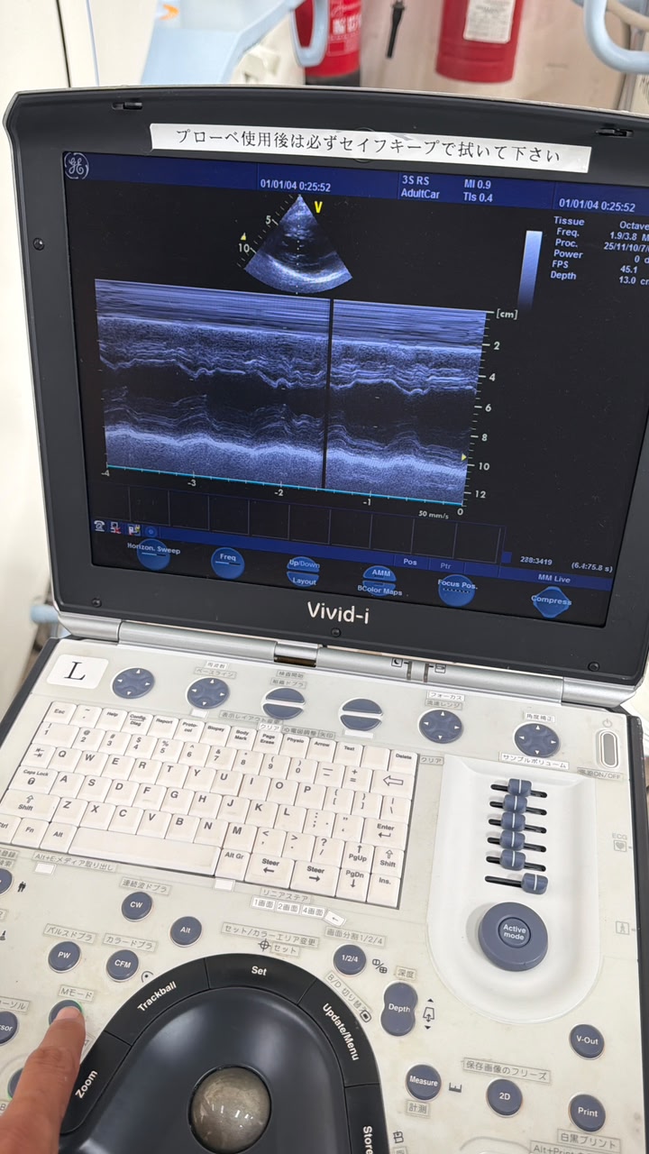 GE Vivid i with Cardiac probe Portable Ultrasound, With printer With trolly refurbished machine