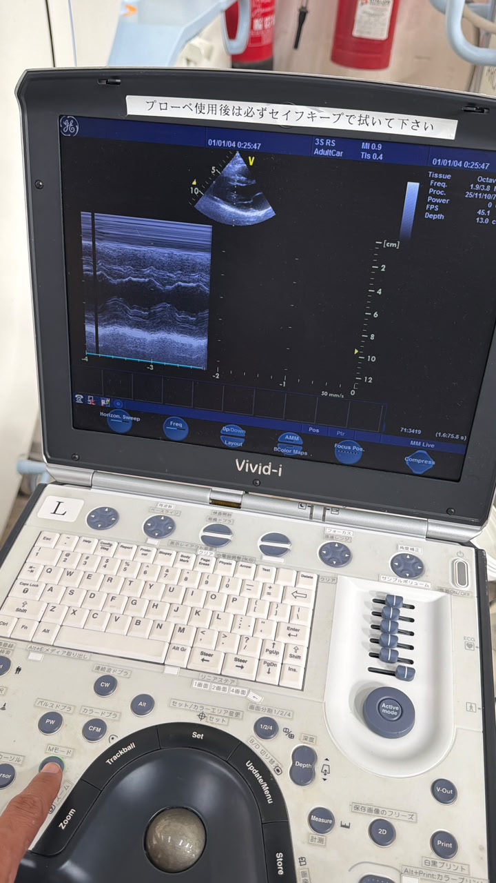 GE Vivid i with Cardiac probe Portable Ultrasound, With printer With trolly refurbished machine