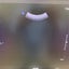 PHILIPS AFFINITI 70G With Convex, Linear and Cardiac refurbished equipment