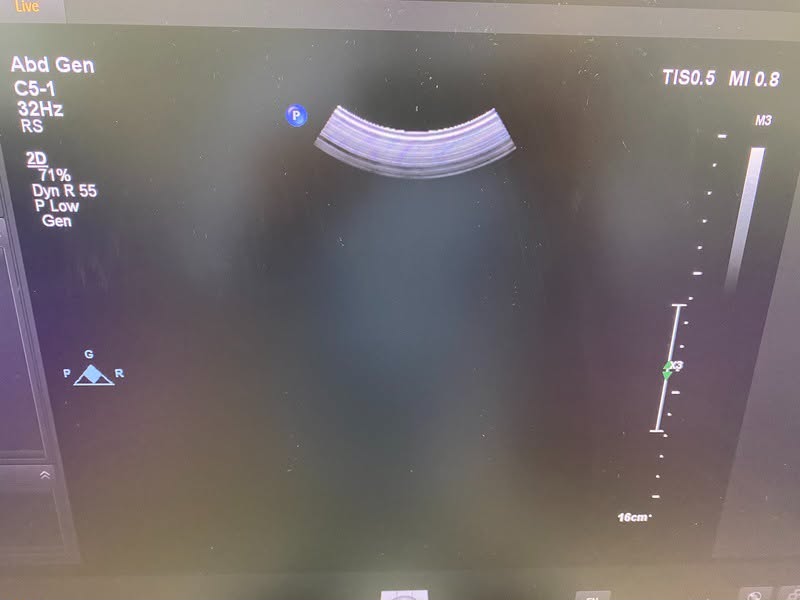 PHILIPS AFFINITI 70G With Convex, Linear and Cardiac refurbished equipment