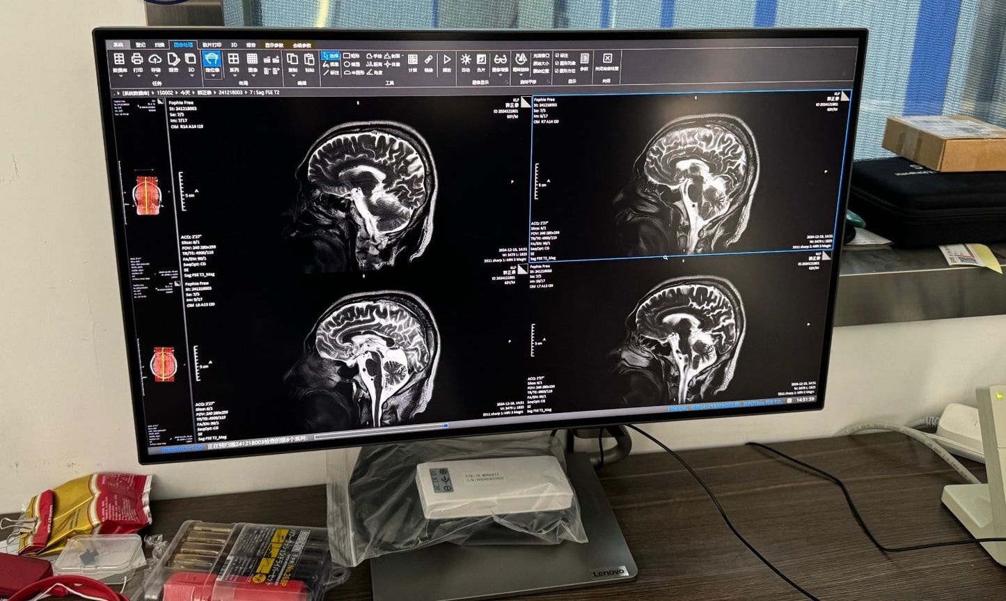 64 Slice CT Scanner with Cardiac Scan | 70cm Aperture | 50kW Power | Hospital Grade (BRAND NEW)