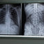 Floor-Mounted Digital DR X-Ray System (Brand New)