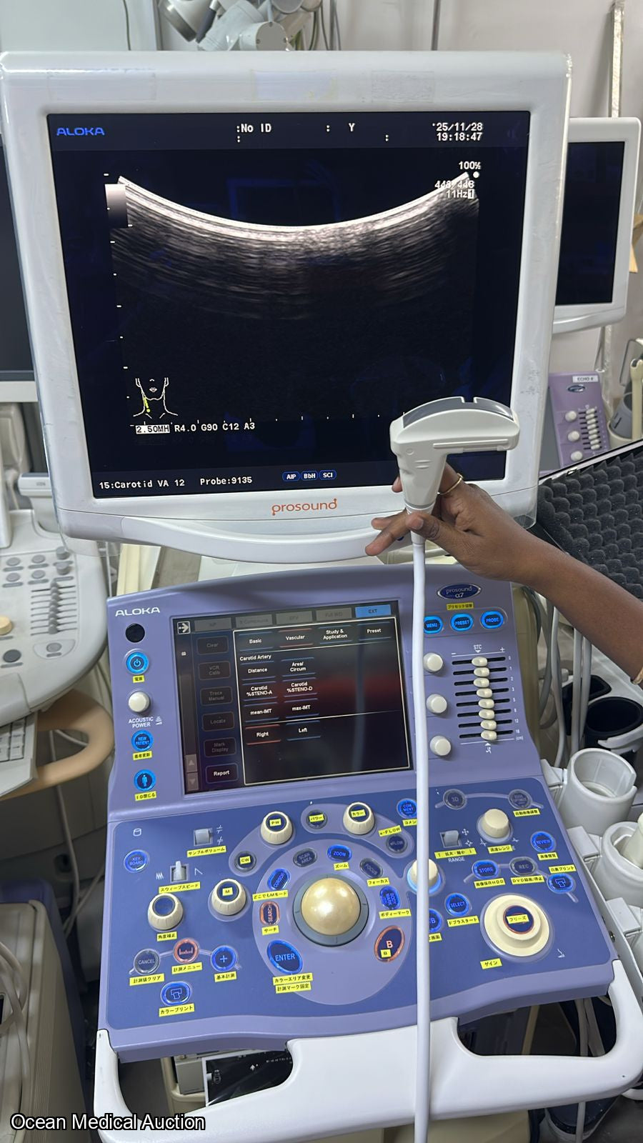 Aloka Ust 9135p curved (convex) array ultrasound transducer / probe.SN.20050045