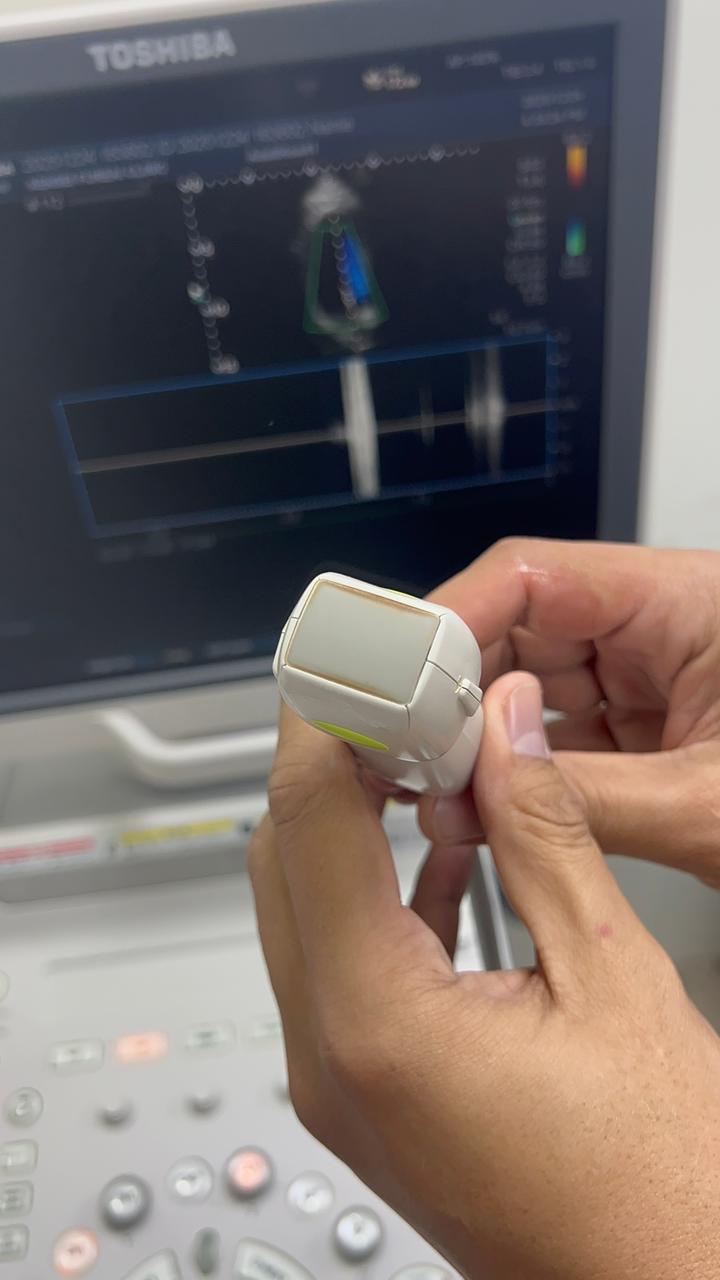 Toshiba Xario 100 ultrasound with cardiac,linear and convex probe refurbished equipment