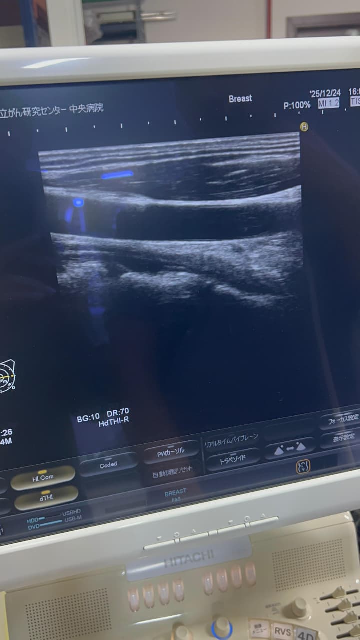 Hitachi Hi Vision preirus ultrasound convex and linear probe