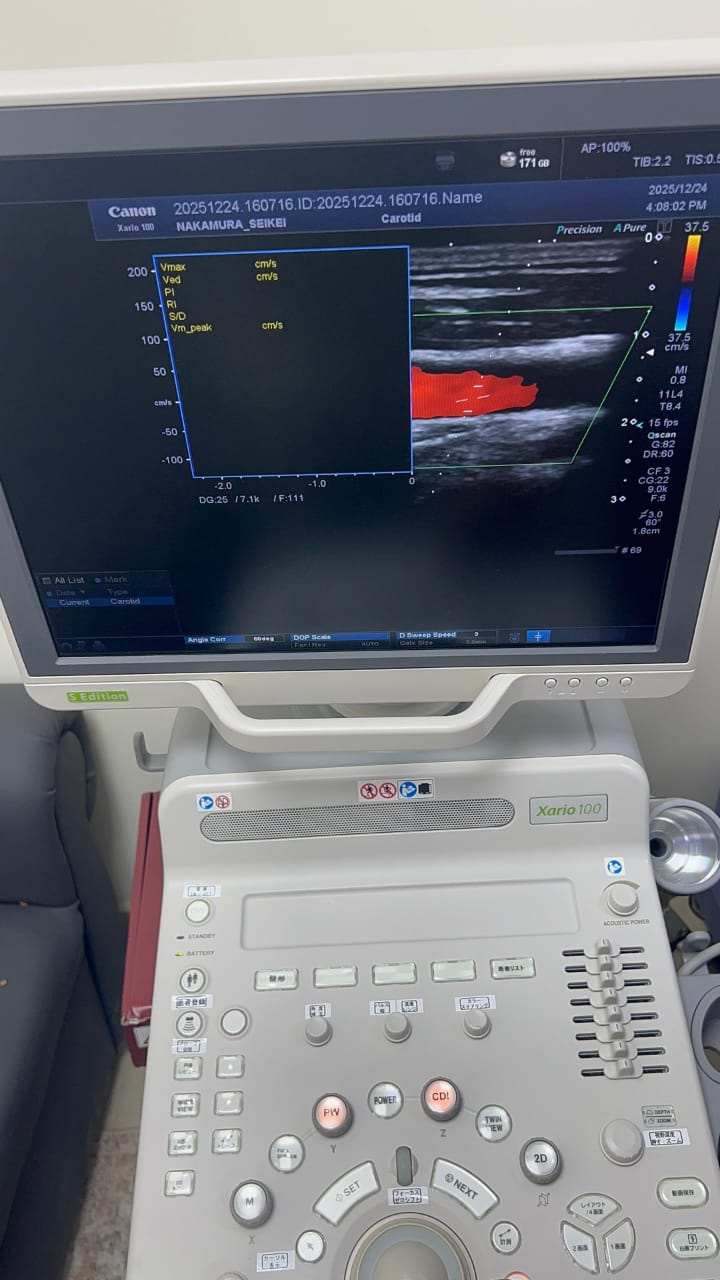 Toshiba xario 100 s edition with linear probe