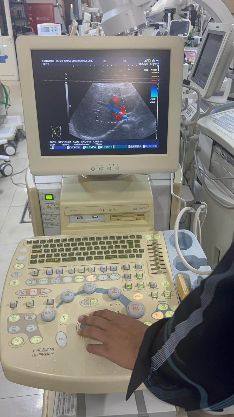Hitachi apron ultrasound with convex and linear probe