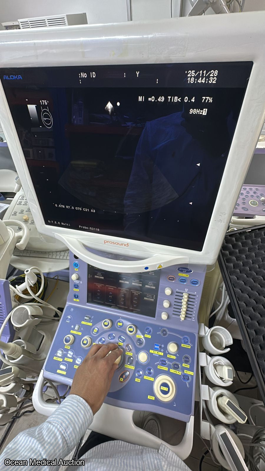 Aloka model ust -52119s sn.200A9387