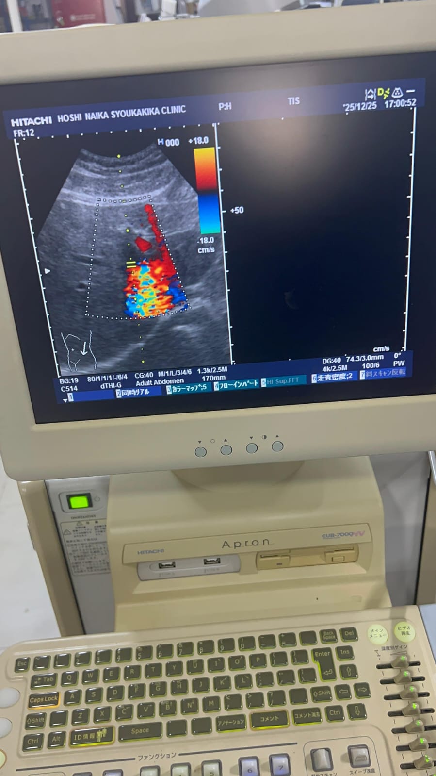 Hitachi apron ultrasound with convex and linear probe
