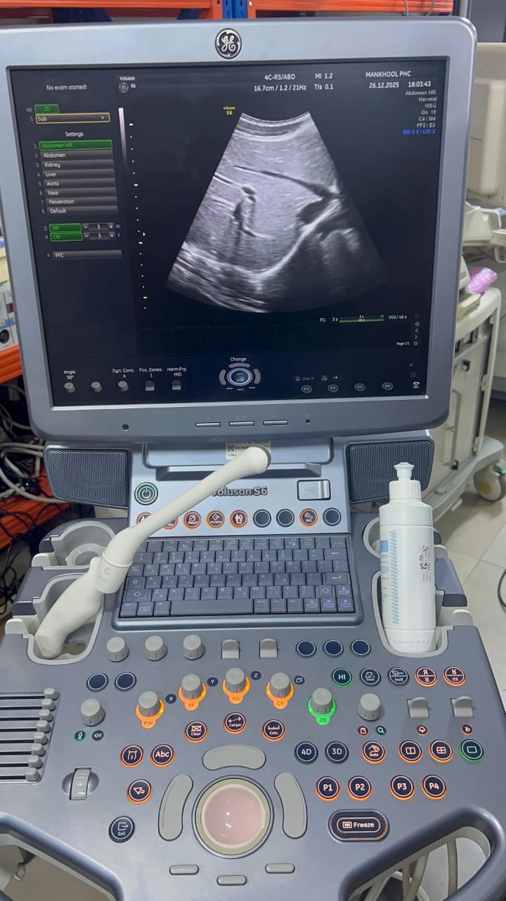 GE Voluson S6 with convex and TVS probe Year 2013