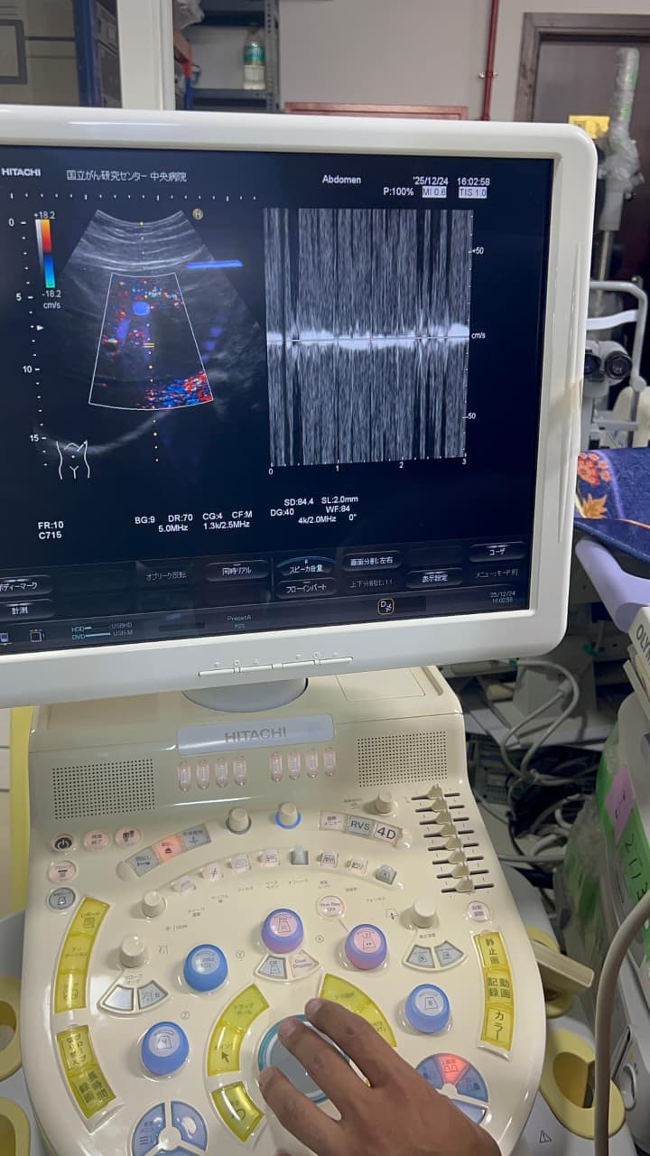 Hitachi Hi Vision preirus ultrasound convex and linear probe
