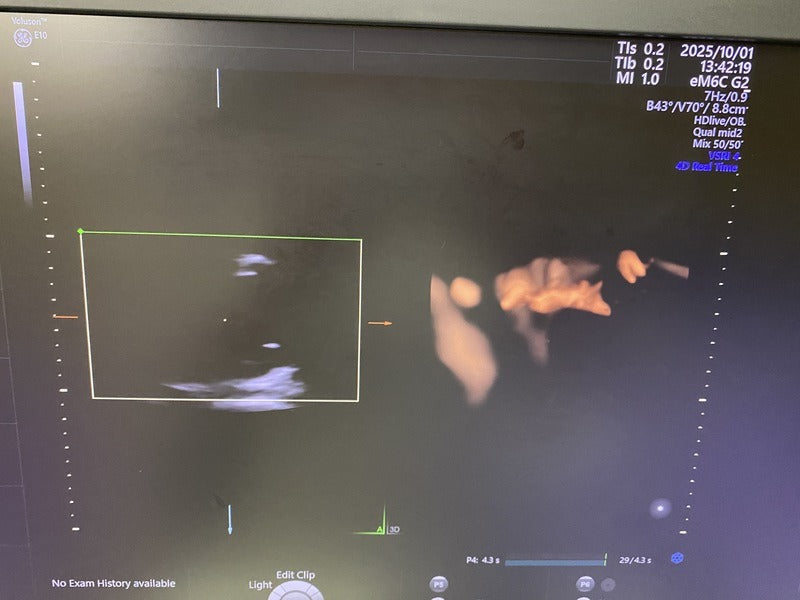 GE voluson E10 (2018 Model) WITH GE RAB / RIC-type 4D Volume Probe