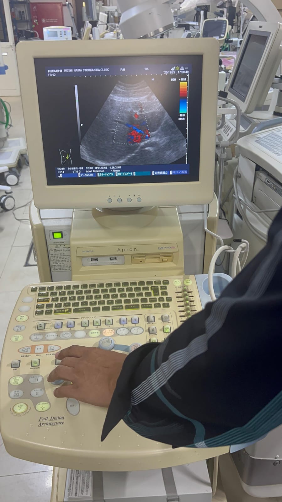Hitachi apron ultrasound with convex and linear probe