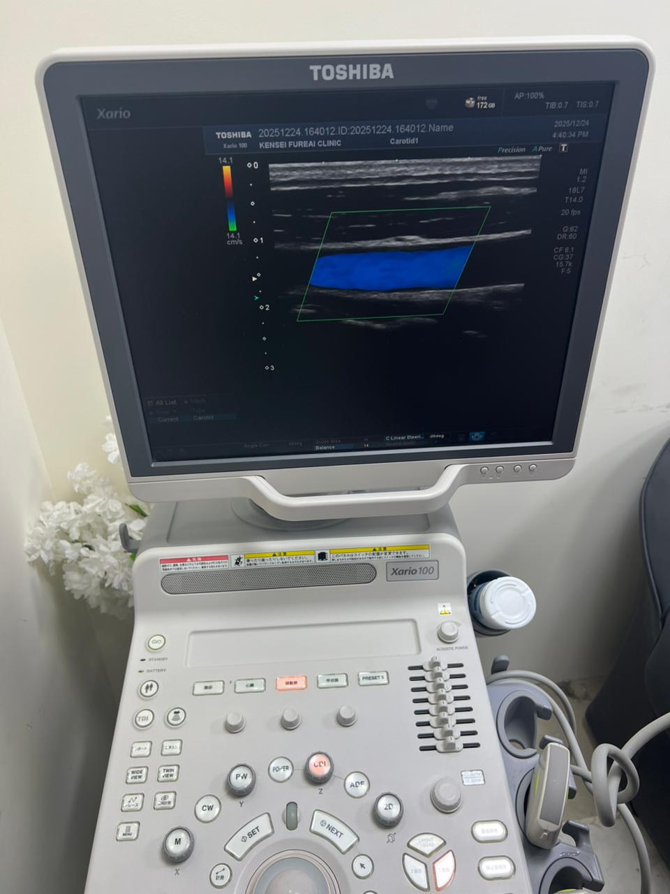 Toshiba Xario 100 ultrasound with cardiac,linear and convex probe refurbished equipment