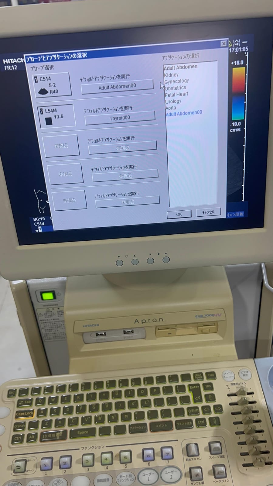 Hitachi apron ultrasound with convex and linear probe