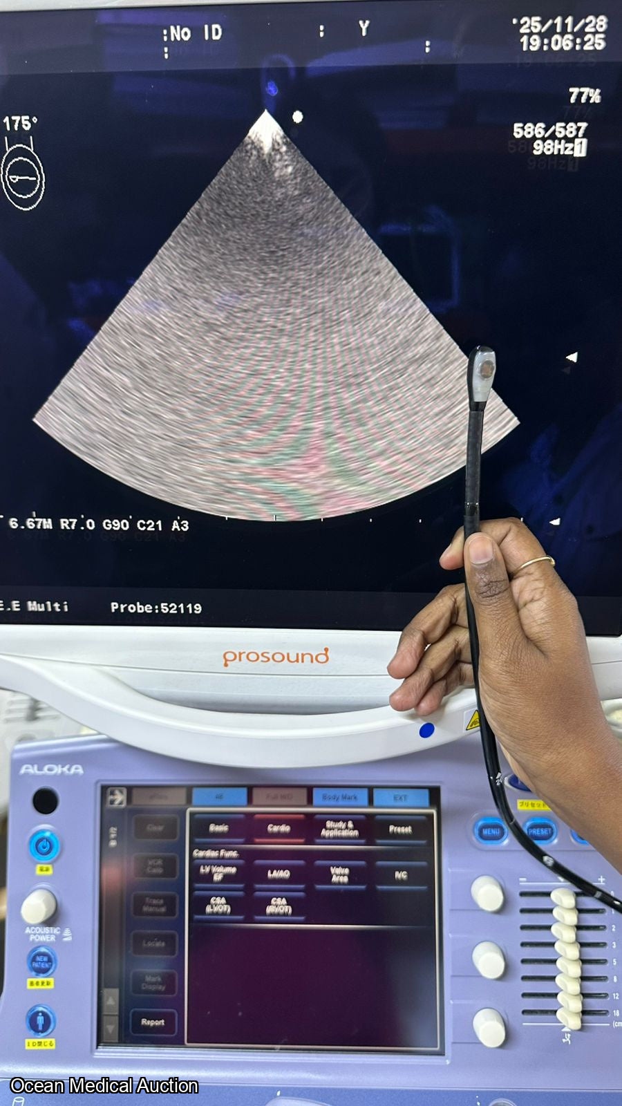 Aloka model ust -52119s sn.200A9387