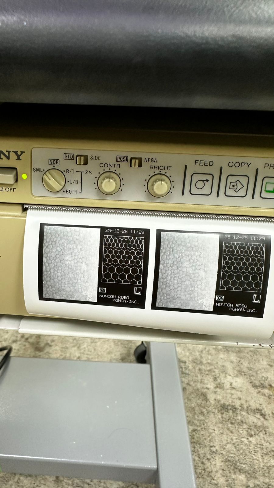 KONAN NONCON ROBO-CA Specular Microscope.