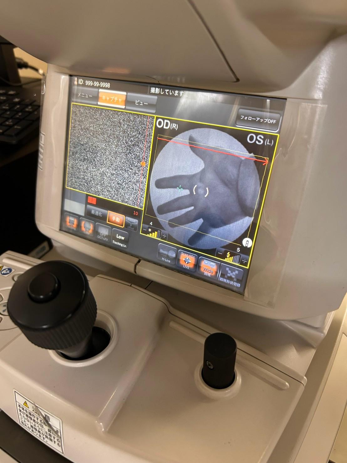 Topcon DRI Triton swept-source OCT System