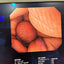 OLYMPUS GIF-Q260 SN.2533156 refurbished equipment
