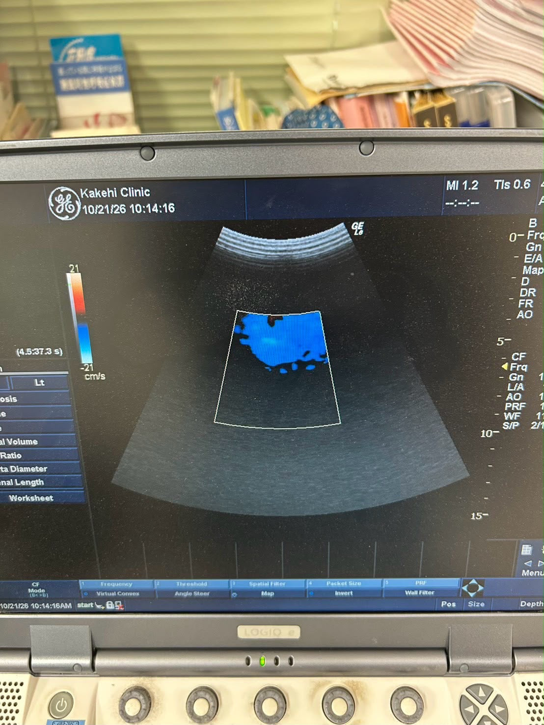 GE LOGIQ e Rev 2 Portable ultrasound