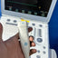 GE Vivid i Portable Ultrasound System (2007) with 3S-RS Cardiac Probe