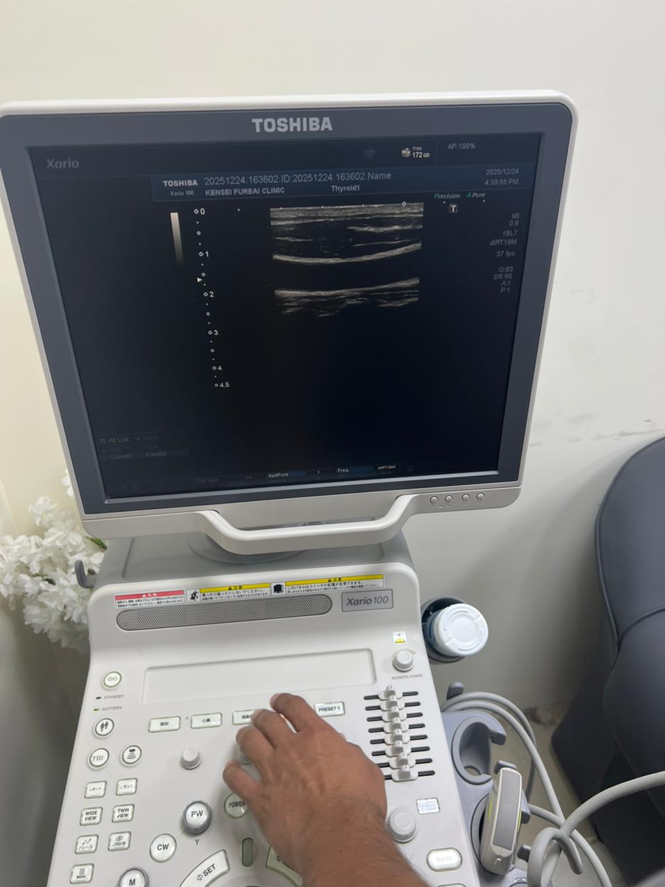 Toshiba Xario 100 ultrasound with cardiac,linear and convex probe refurbished equipment