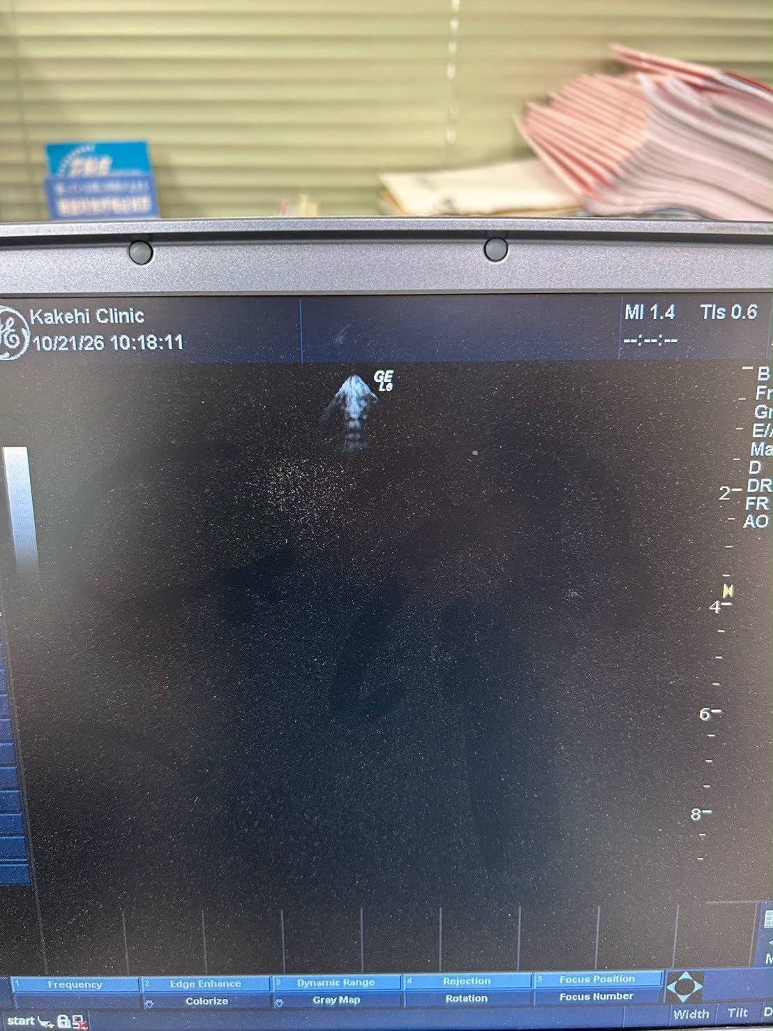 GE LOGIQ e Rev 2 Portable ultrasound