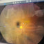 ZEISS CLARUS 500