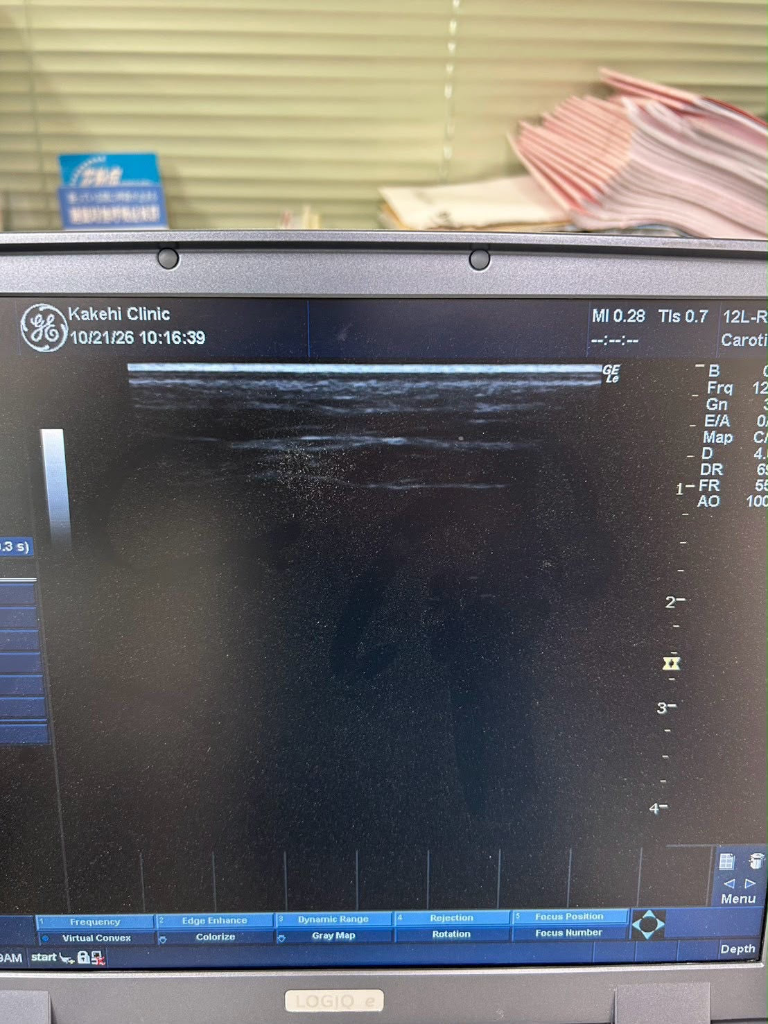 GE LOGIQ e Rev 2 Portable ultrasound