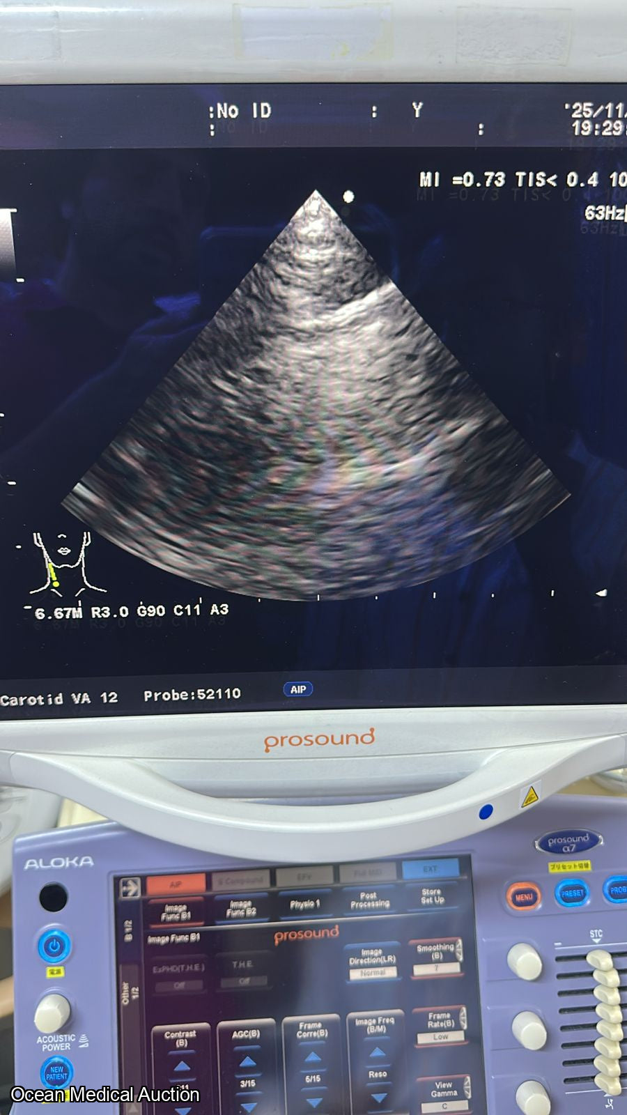 Aloka ust 52110s neonatal / pediatric T.E.E. SN.20004764