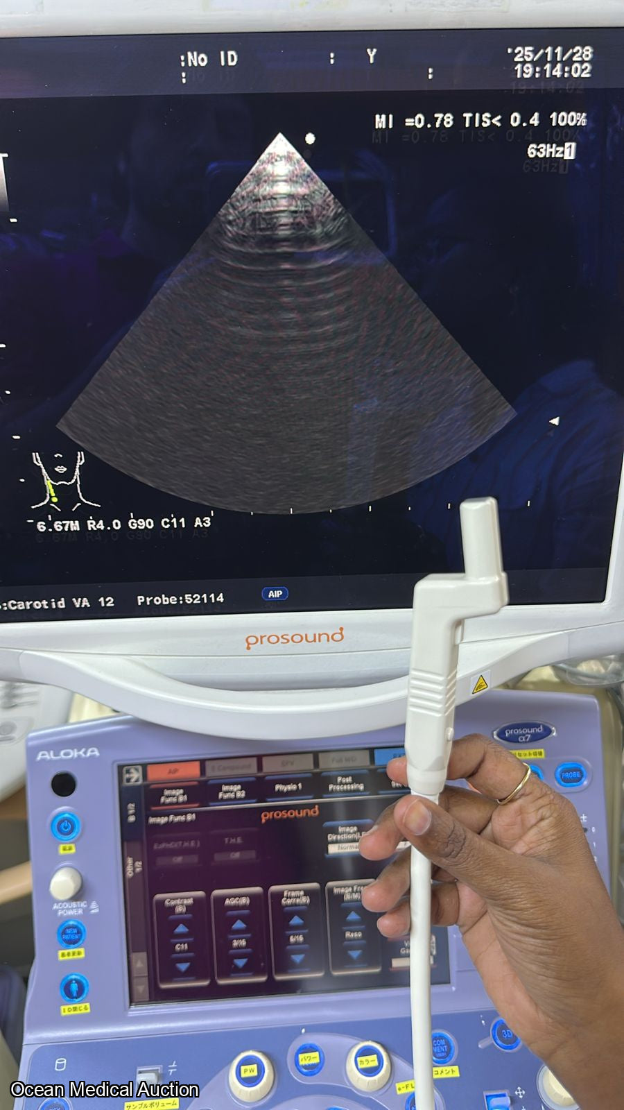 Aloka ust 52114P ntraoperative / phased-array ultrasound transducer (probe) SN.200D3785