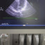 Philips s5-1 cardiac probe sn. 03FG2X checked dxb IS (MW)