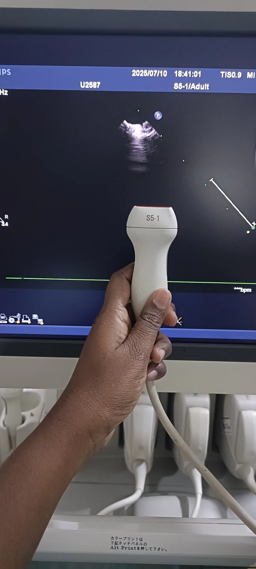 Philips s5-1 cardiac probe sn. 03FG2X checked dxb IS (MW)