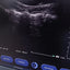 Siemens TVS PROBE SN. (21)81308013 checked dxb IS (MW)