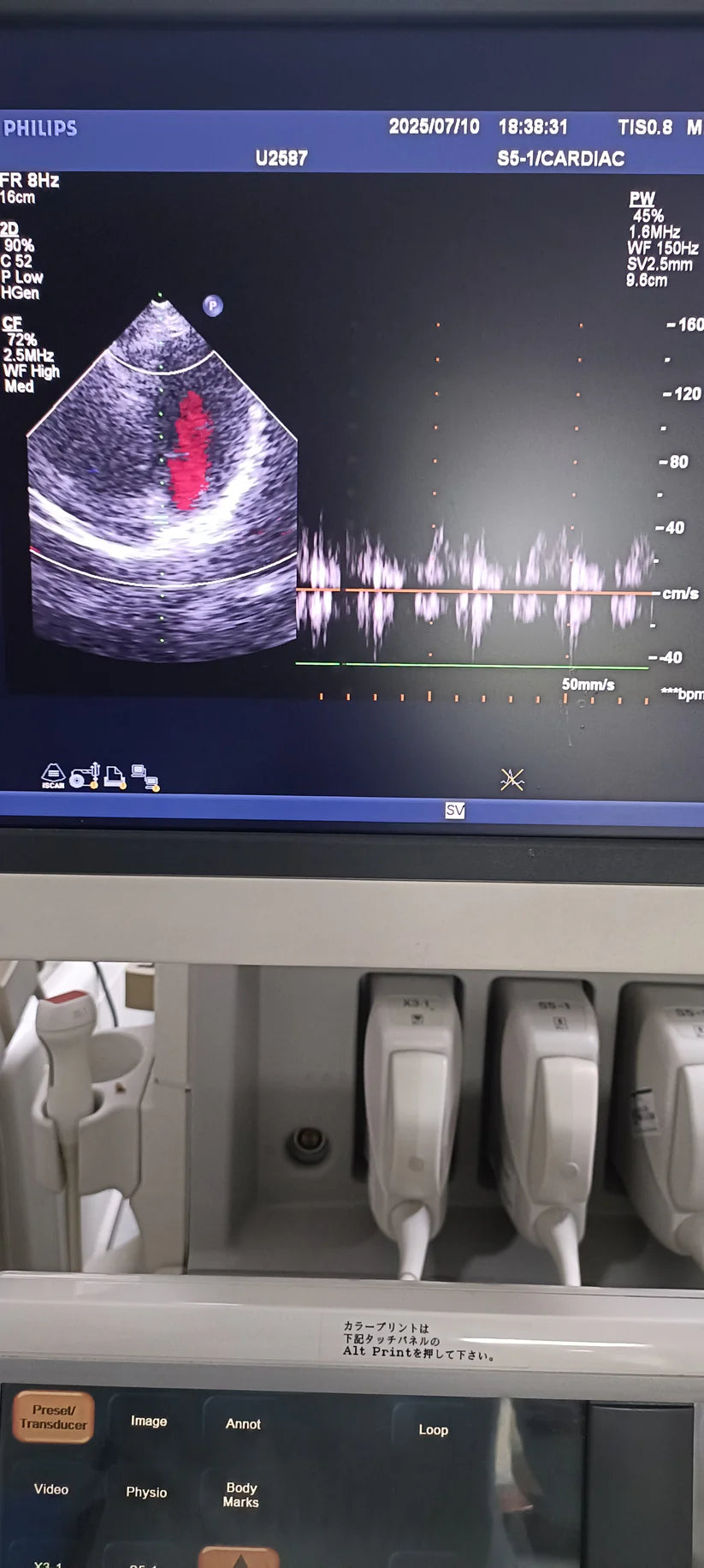 Philips s5-1 cardiac probe sn. 03FG2X checked dxb IS (MW)