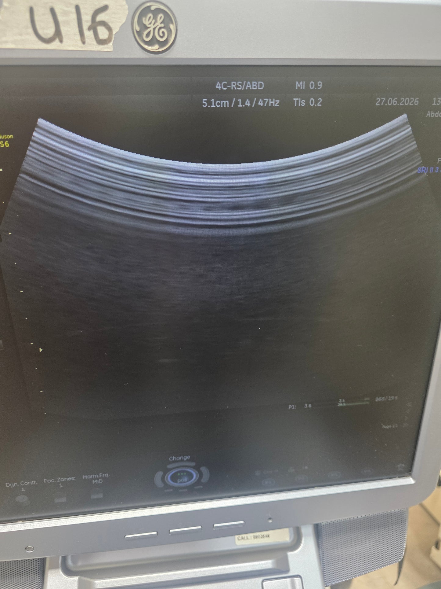 GE-4C-RS CONVEX ULTRASOUND PROBE/TRANSDUCER FOR GE VOLUSON S6 ULTRASOUND MACHINE. BH