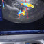 GE E8C TVS PROBE SN. 111683WX9 CHECKED DXB IS(MW)
