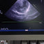 Philips s5-1 cardiac probe sn. 03FG2X checked dxb IS (MW)