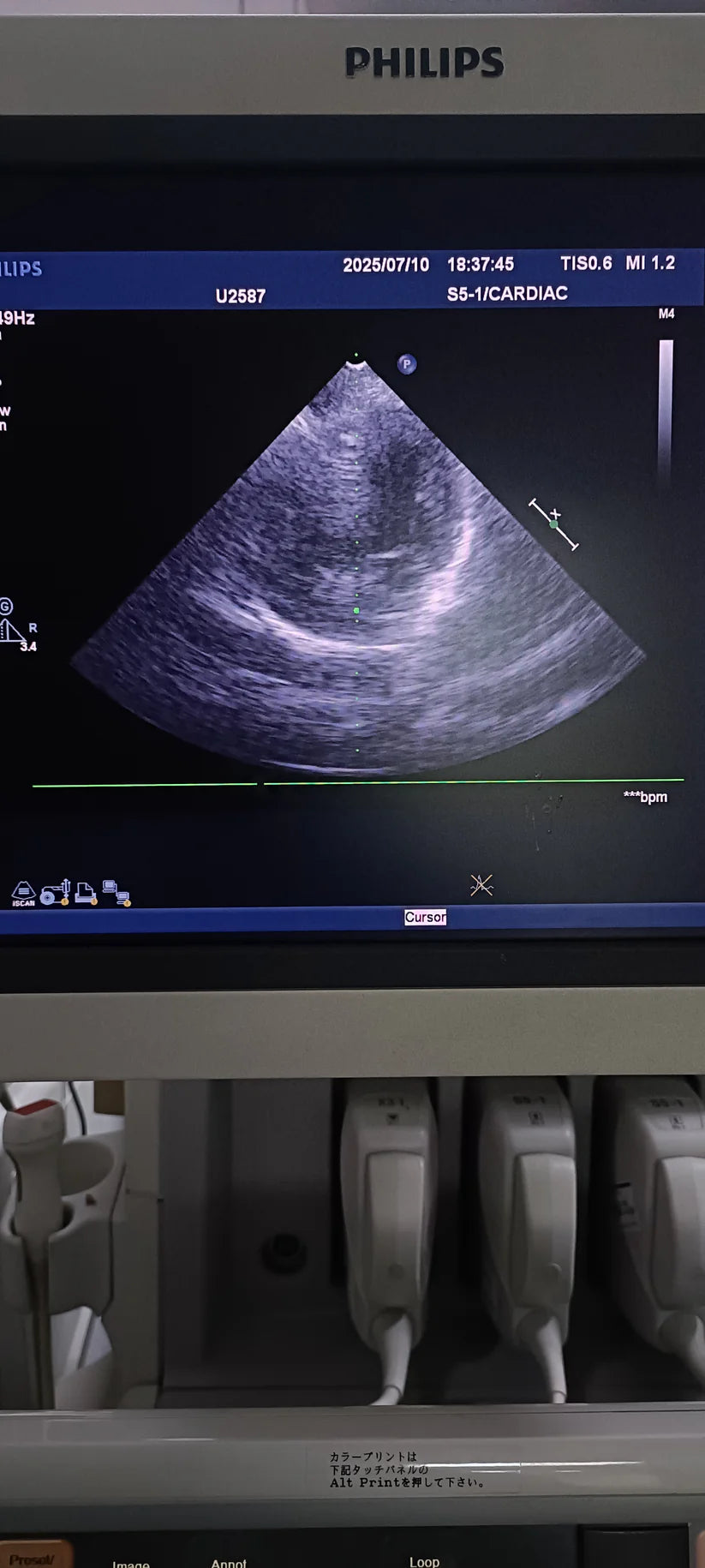 Philips s5-1 cardiac probe sn. 03FG2X checked dxb IS (MW)