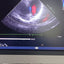 Philips s5-1 cardiac probe sn. 03FG2X checked dxb IS (MW)